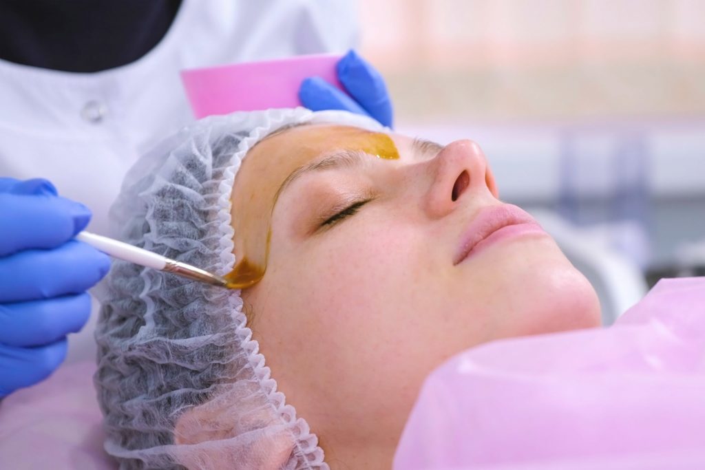 Chemical Peels The Benefits and the Different Conditions Treated